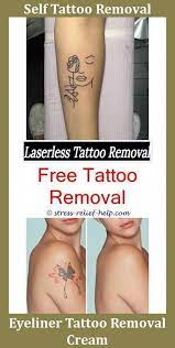 Upgraded skin care tool kits spot tattoo freckle removal mole laser plasma pen. Tattoo Removal Jackson Ms Tattoo Design