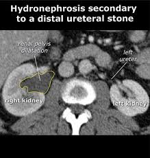 Startradiology Diagnostic Imaging Radiography Radiology Student