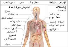 وأضاف، أن في سلطنة عمان جرى اكتشاف 4 حالات يُعتقد أنها من السلالة الجديدة، وجرى دراسة هذه الحالات، ويُجرى التأكد من انتمائها للسلالة الجديدة المنتشرة في بريطانيا وبعض الدول الأخرى منذ سبتمبر الماضي. Ù…Ø±Ø¶ ÙÙŠØ±ÙˆØ³ ÙƒÙˆØ±ÙˆÙ†Ø§ 2019 ÙˆÙŠÙƒÙŠØ¨ÙŠØ¯ÙŠØ§