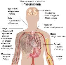 Pathophysiology pathophysiology of community acquired pneumonia precipitating factor 1. Community Acquired Pneumonia