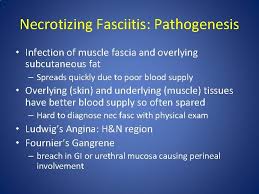 Maybe you would like to learn more about one of these? Surgical Foundations Infectious Disease Topics In Surgery Surgical