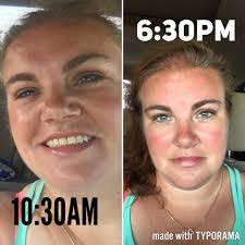 Please forgive me Senne. Day 2 game 1 bomb squad!!! Congrats to Senne