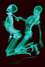 Из серии X-ray professional photo, 2011 лот по аукциону украинского  искусства