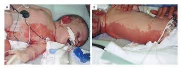 Image result for Harlequin Color Change