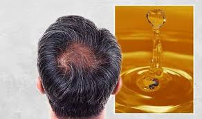 Manuka honey helps in pulling out grime and dirt from the pores of the hair follicles and making them grow better. Hair Loss Treatment Honey May Stop The Causes Of Hair Loss Express Co Uk