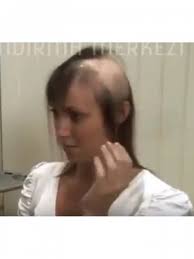 Protez Video
