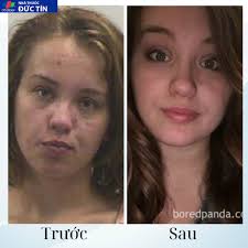 HOT]Kem Cai Thuốc Lá Kanye HB