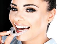 So how long does invisalign take to work? Invisalign Chester Masters Orthodontics