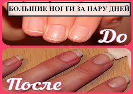 как нарастить ногти за 5 минут в домашних условиях Bolshie Nogti Za Paru Dnej Otrastit Nogti Prochnye Nogti Zdorovye Nogti