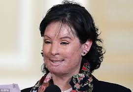 Lea aquí todas las noticias sobre natalia ponce de león: Fundacion Natalia Ponce De Leon Colombia Acid Attack Victim Makes First Public Appearance Without A Mask