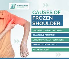Image result for Frozen Shoulder