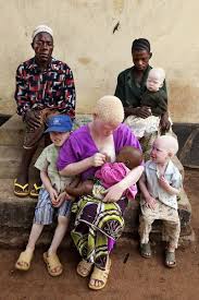 Black Babies Born White Then Turn Black Liron Shimoni Lightstalkers Foto Di Bambini Colori Della Pelle Foto