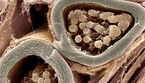 Maybe you would like to learn more about one of these? Encefalitis Aguda Diseminada Causas Sintomas Y Diagnostico