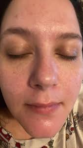 Cindy's facial services and celluma treatment for skin improvement
