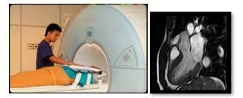 Mri pet ct centre is the best mri scan centre in delhi ncr, providing the best 1.5 and 3 tesla mri scan in delhi at various locations in affordable we have the best mri scan centres in delhi ncr, book your test online, no waiting time, no hidden charges. Cardiac Mri Scan Ijn