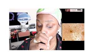 SPA SCIENCES: MIO MICRODERMABRASION TOOL REVIEW