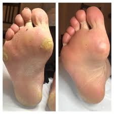 The Omagh Foot Clinic