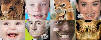 George washington never had wooden teeth, nor did anybody of his time. History Of Teeth Teeth Through Time