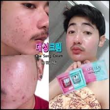 แดซองครีม Dae Song Cream ครีมเกาหลี (โปรส่งฟรี)