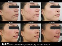 Official jan marini skin research facebook page. My Jan Marini Skincare Consultation Lauren Erro