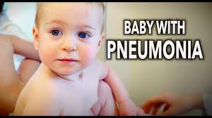 Pneumonia is often caused by an upper respiratory infection, such as the flu, that spreads to the lungs. Cute Baby With Pneumonia Dr Paul Youtube