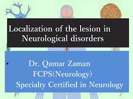 Image result for Neurologic Lesion Localization