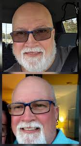 Importance of eye protection at beach