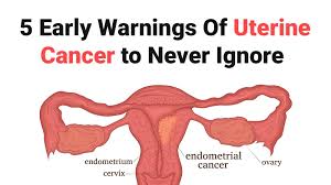 In general, there are no early signs of cervical cancer. 5 Early Warnings Of Uterine Cancer To Never Ignore
