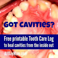 Many home remedies can prevent cavities or stop them at a very early stage. How To Heal Cavities Naturally And Free Printable Tooth Care Log For Kids All Day Mom