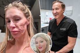 Brandi Glanville undergoes 4 biopsies by Dr. Terry Dubrow to figure out  cause of facial disfigurement