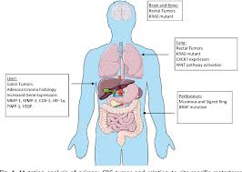 Metastatic colon cancer can be diagnosed with the use of blood tests and other diagnostic examinations. Surgical Treatment Of Metastatic Colorectal Cancer Semantic Scholar