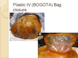 A ring shaped black polyurethane foam of the vac system was placed. Abdominal Compartment Syndrome In Trauma David Chow Supervisors