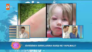 Sivrisinek Isiriklarina Karsi Ne Yapmali Saglikli Mutlu Huzurlu 138 Bolum Atv Youtube