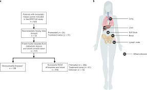 The osteoclasts can become overactive, causing more bone to be broken down than is being replaced. The Genomic Landscape Of Metastatic Breast Cancer Highlights Changes In Mutation And Signature Frequencies Nature Genetics