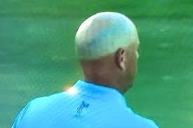 Stewart cink is professional from 1995. Pga Golfer Stewart Cink Has An Unreal Tan Line On His Head Bleacher Report Latest News Videos And Highlights