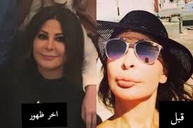 يقول الكثيرون ان اليسا كانت أجمل وأكثر نعومة قبل عمليات التجميل الكثيرة التي أجرتها والتي غيرت ملامح وجهها تماما. ØªØ¯Ø§ÙˆÙ„ ØµÙˆØ±Ø© Ø¥Ù„ÙŠØ³Ø§ Ø¨Ø¹Ø¯ Ø¥Ø²Ø§Ù„Ø© Ø§Ù„ÙÙŠÙ„Ø± Ù…Ù† Ø´ÙØªÙŠÙ‡Ø§ ÙƒÙŠÙ Ø£ØµØ¨Ø­Øª Ø¯Ù†ÙŠØ§ Ø§Ù„ÙˆØ·Ù†