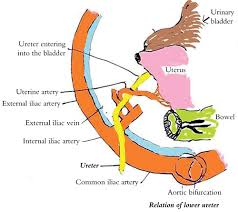 Visualization of pelvic anatomy and the ability to minimize blood loss is superior with tlh. Slh Chapter 2 Anatomy Of The Ureter Glowm