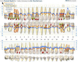 what is tooth charting and teeth numbers chart meaning