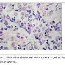 The goal is to spot the clinical signs of the condition as soon as possible to give your pet the best chance of survival. Pdf A Retrospective Study Of Primary Lung Tumor In Dogs