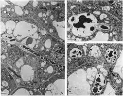 Find the perfect transmission electron microscope stock photos and editorial news pictures from getty images. Bacterial Release Transmission Electron Microscopy A Infection Download Scientific Diagram