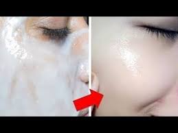 Ev Yapimi Dogal Botoks Maskesi Aninda Genclestiren Kirisik Gideren Cilt Rengini Acan Maske Youtube Cilt Bakimi Cilt Beyazlatma Cilt Rengi