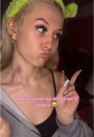 How to Do Light Makeup to Cover Bruise