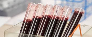 When i saw a doctor, i was given a glucose tolerance test. Blood Transfusions Side Effects And Reactions Red Cross