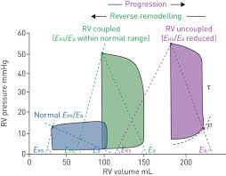 Pathophysiology Of The Right Ventricle And Of The Pulmonary