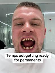 Turkey Teeth Getting Fitted