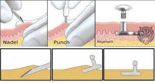 How Dermal Piercing Is Done Dermal Piercing Piercing Dermal Piercing Chest