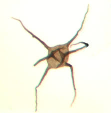 Image result for Acritochaete