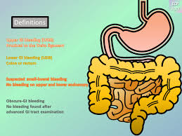 Image result for Small Intestinal Bleeding