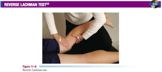 Image result for Lachman Test