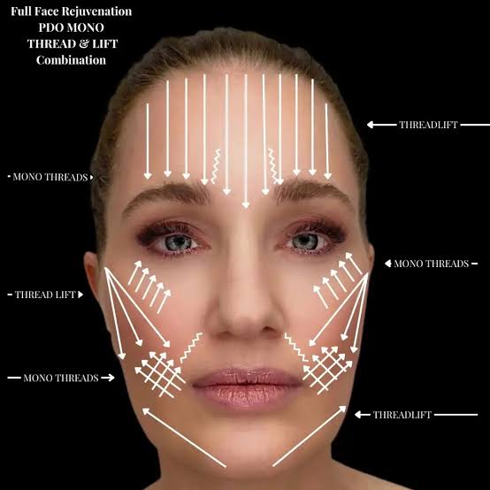 PDO Threads - Spectrum Dermatology of Seattle
